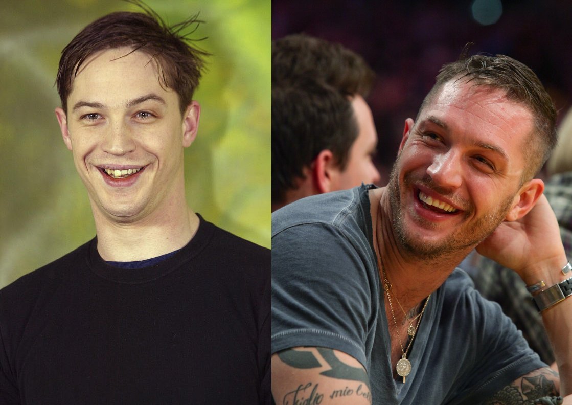 tom hardy and his teeth