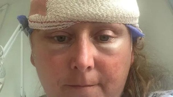 Objawy przypisywane menopauzie okazały się guzami mózgu. Brytyjka usłyszała wstrząsającą diagnozę