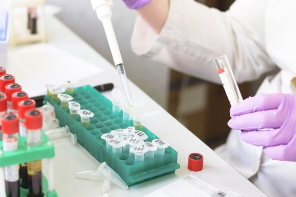Grupa krwi A zwiększa ryzyko udaru do 60 roku życia: wnioski z ogólnokrajowego badania