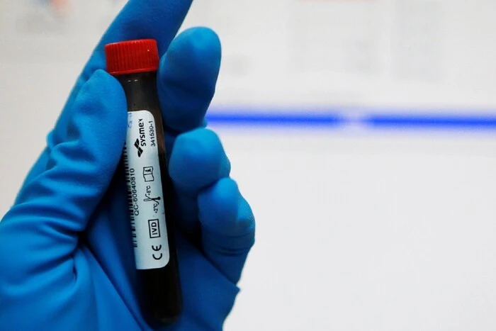 Neues Doping-Testsystem für die WM 2025: Was sich für die Athleten ändert