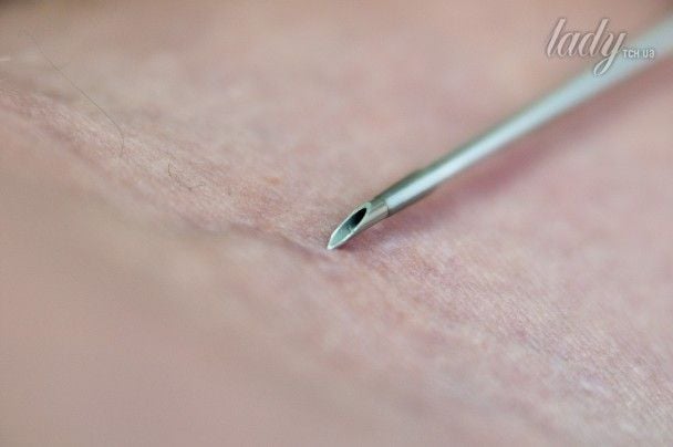 Od kwietnia 2024 roku Ukraina rezygnuje z próby Mantou – nowa metoda wykrywania gruźlicy