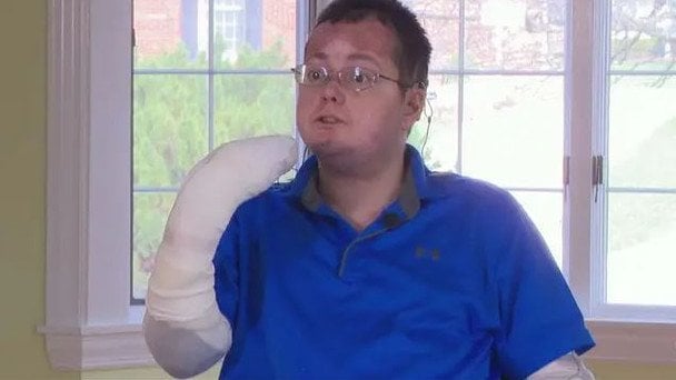 Walka o darmowe opatrunki: mężczyzna z „zespołem motyla” zmaga się z rachunkiem za leczenie w wysokości 80 tysięcy dolarów