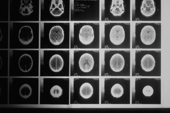 Künstliche Intelligenz von Microsoft übertrifft Ärzte bei der Diagnose komplexer Krankheiten