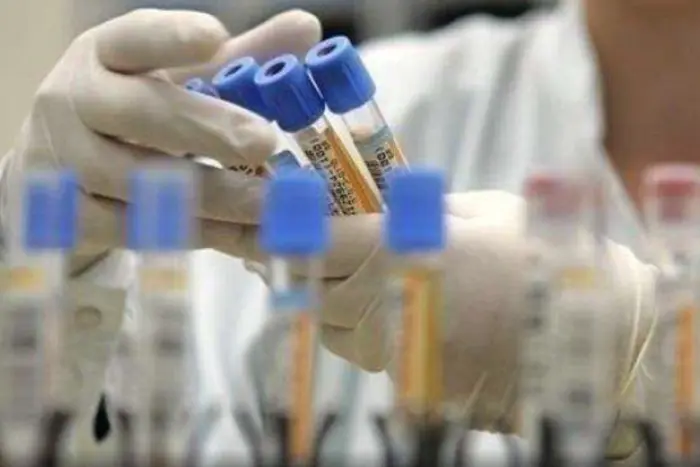 Епідемія ВІЛ та гепатиту в армії РФ: чому хворих не відкликають з фронту