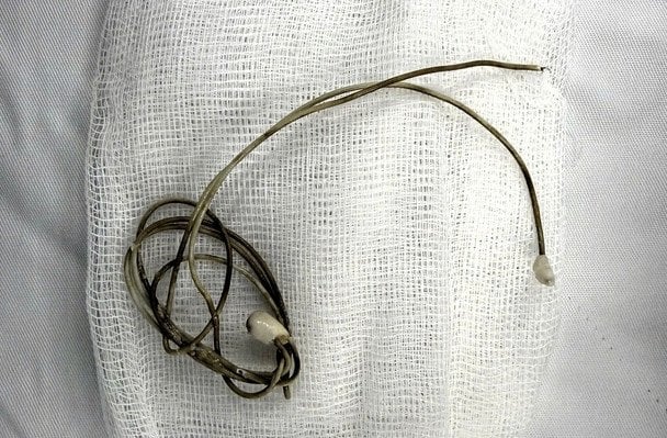 W Wietnamie wyciągnięto kabel telefoniczny z pęcherza moczowego nastolatka