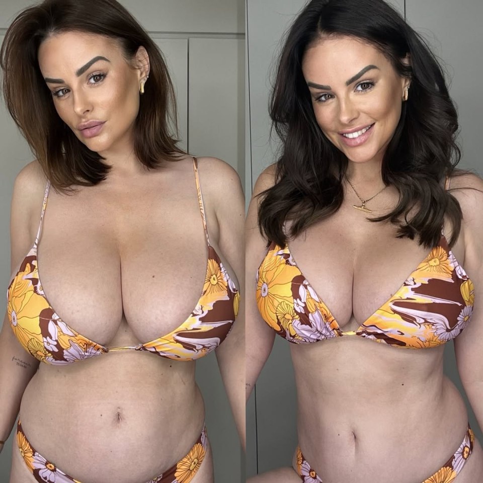 Model Rhian Sugden underwent breast reduction surgery: how her body has changed