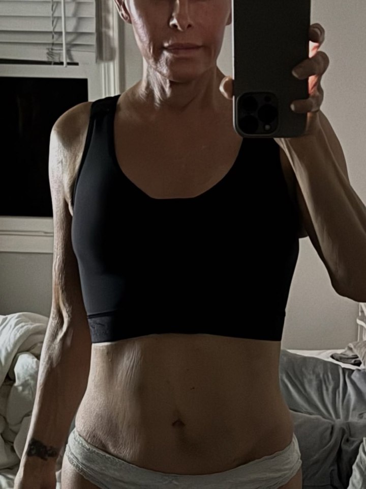 Baywatch star Nicole Eggert underwent a mastectomy: details of her battle with cancer