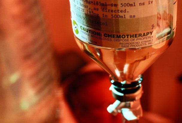 Chemioterapia przez osiem lat zamiast pół roku: historia tragicznej pomyłki medycznej