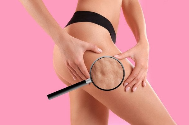 Diety 0% tłuszczu powodują cellulit: dlaczego odtłuszczone produkty szkodzą skórze