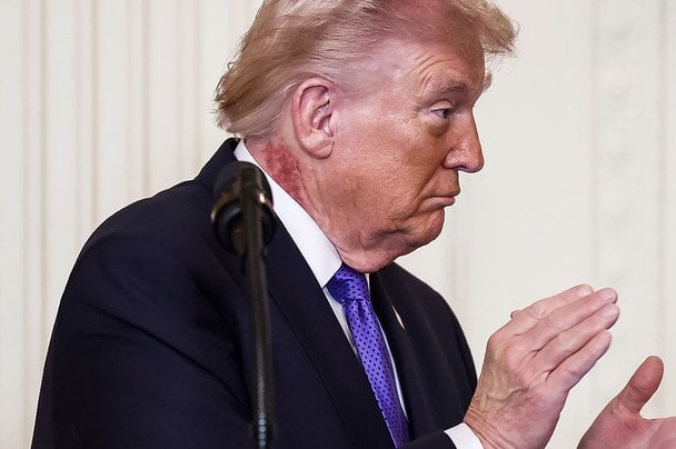 Lekarz Trumpa wyjaśnia przyczynę zaczerwienienia na szyi. To krem ochronny