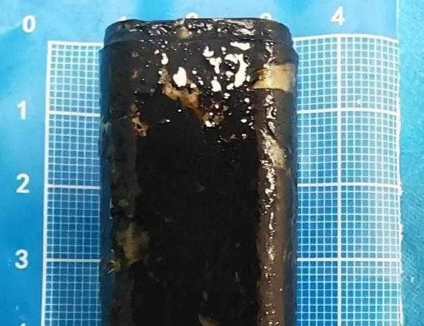 Chińczyk przez 30 lat nosił w żołądku działający zapalnik: jak go wydobyto
