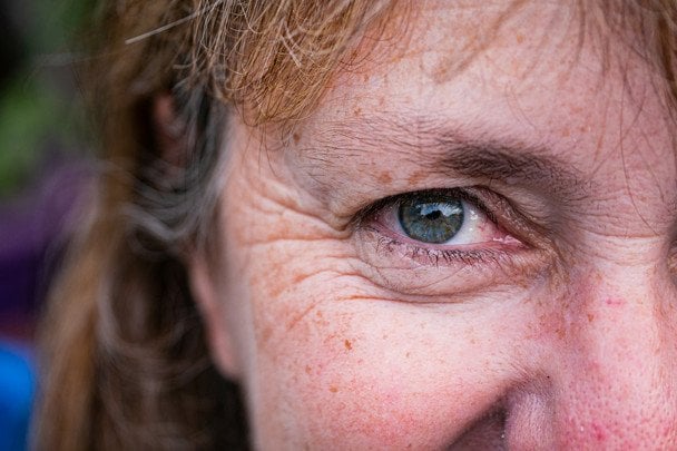 Cukier rafinowany przyspiesza starzenie: jak słodycze niszczą kolagen