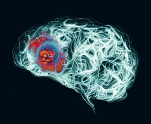 Dementia i Alzheimer: jakie są różnice między najczęstszymi chorobami mózgu