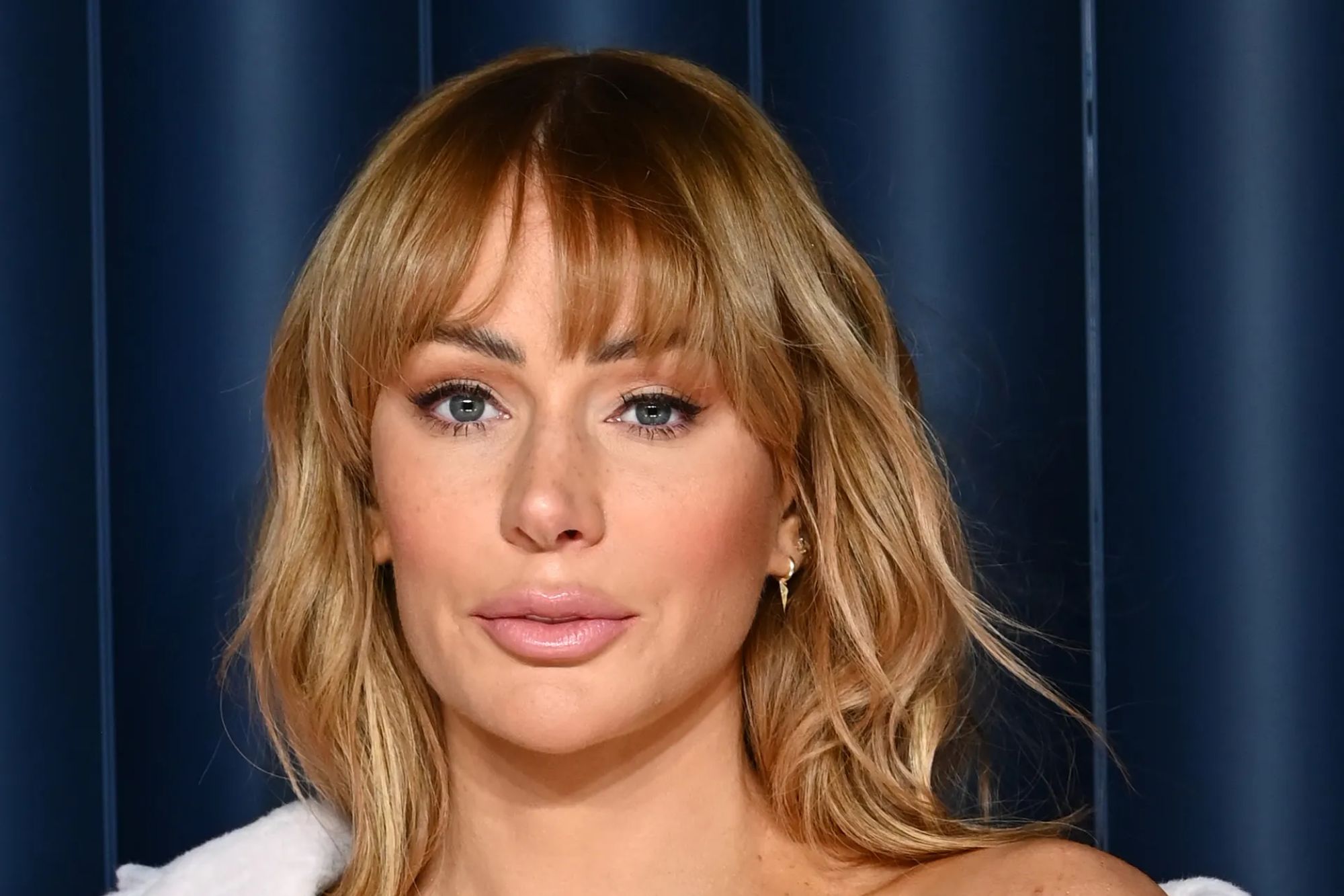 Olivia Attwood revealed details of cruel criticism over plastic surgeries