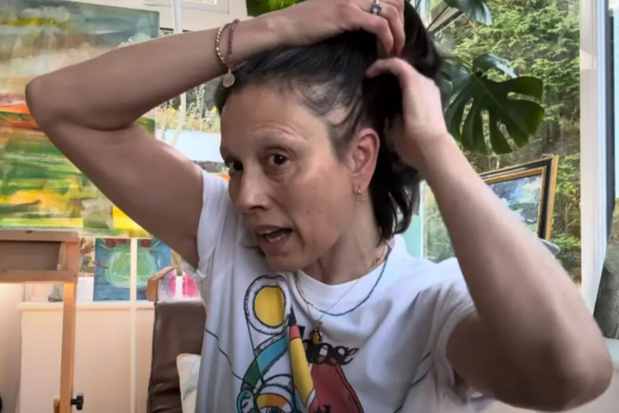 Famous host Melanie Sykes announced hair loss due to autoimmune disease