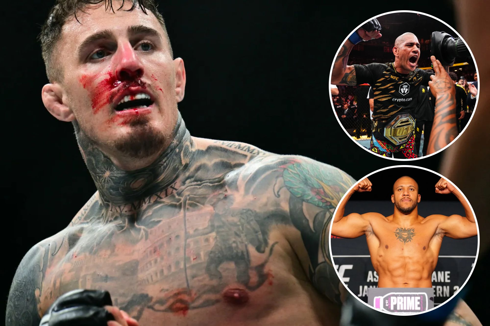 Том Аспіналл отримав важку травму ока: коли чемпіон UFC повернеться в октагон