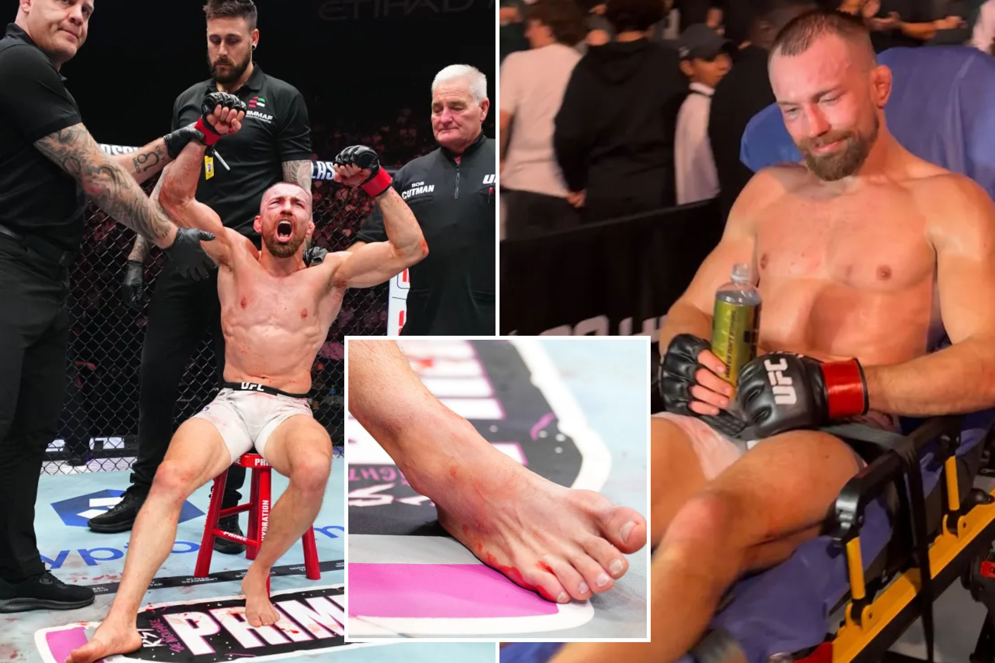 Травма бійця UFC у Абу-Дабі: Людовіт Кляйн зламав щиколотку під час бою
