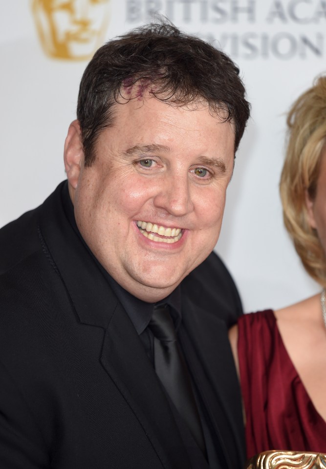 Peter Kay cancels concerts due to surgery: details on health status