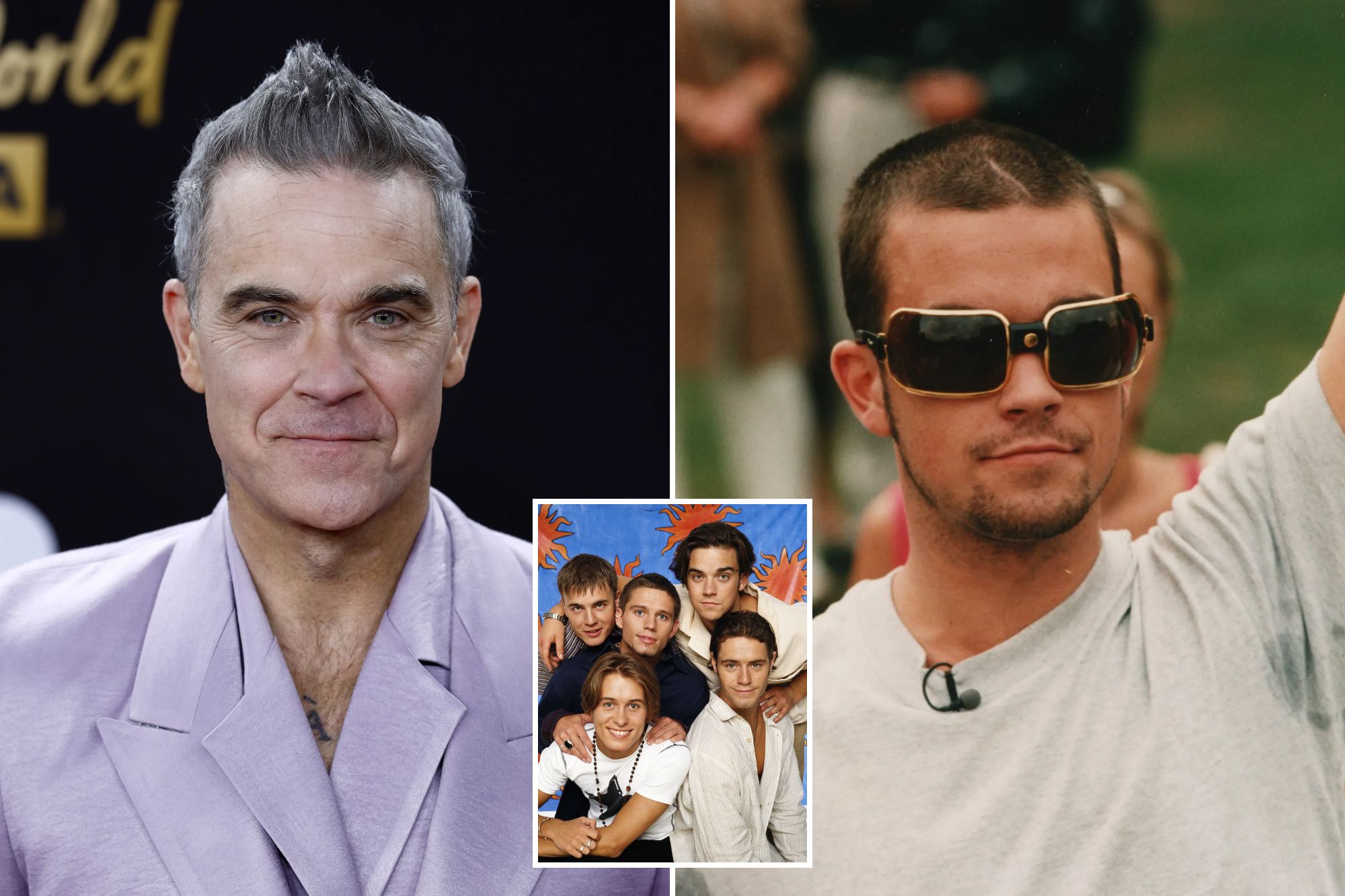 Robbie Williams admits to hair loss