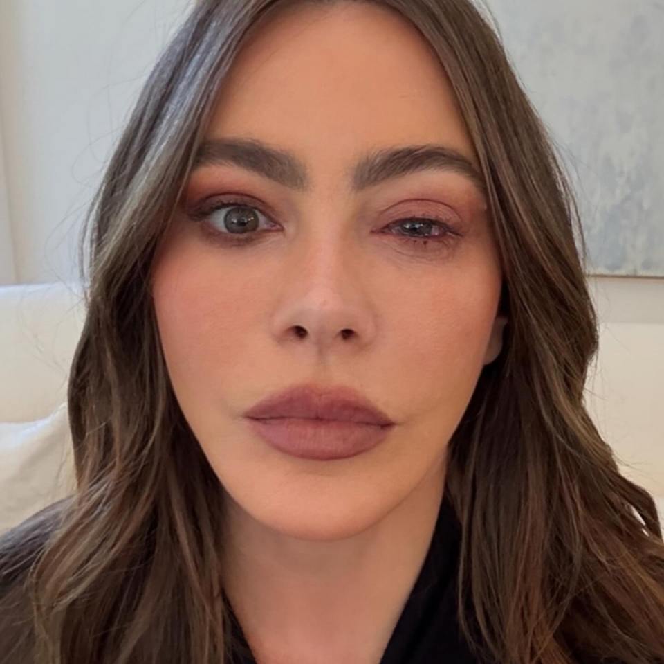 Sofia Vergara was hospitalized due to an allergy right before the Emmy awards ceremony