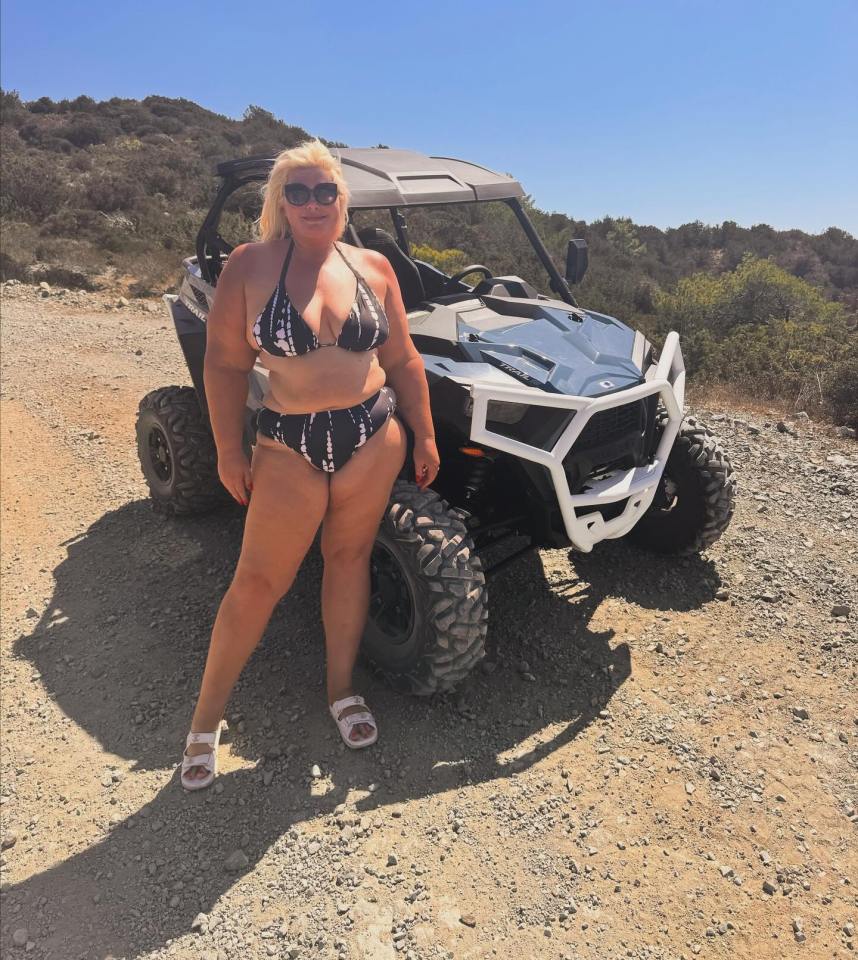 Gemma Collins shows impressive weight loss as she poses in a bikini after switching to fat injections